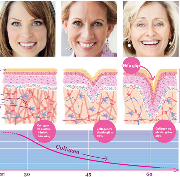 nâng cơ mặt xóa nếp nhăn